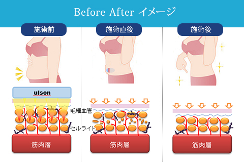 Before After イメージ